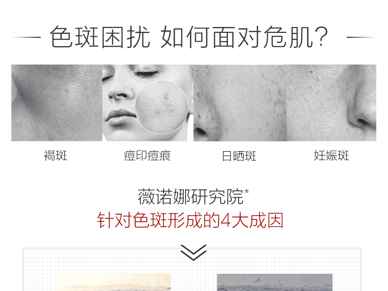 薇诺娜（WINONA）光透皙白淡斑精华液30ml