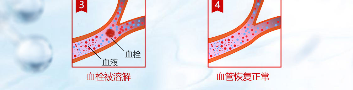 FNZ/日本菲牛蛭-移动_07.jpg