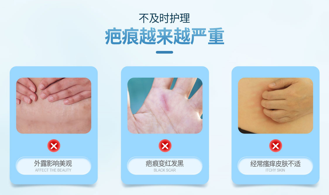 kelo_cote/芭克S2无线_04.jpg