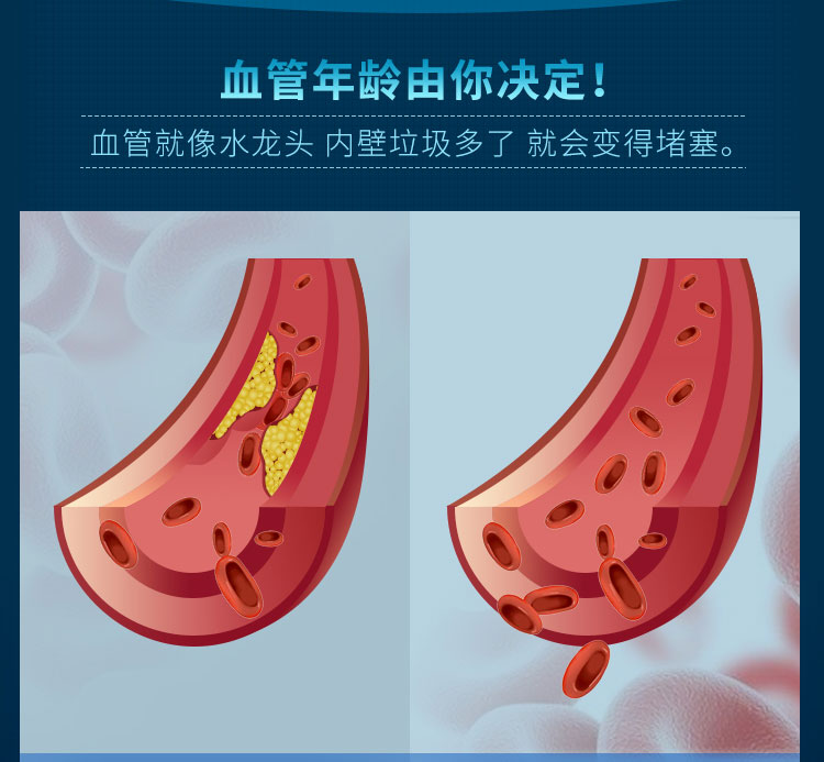 维萃ç¾?Victorymade)五å€纯净三重深海鱼油1500mg*60粒ã€美版升级版ã€