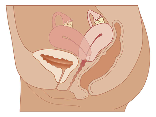 19.gif