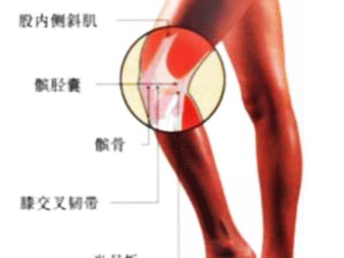 滑膜炎