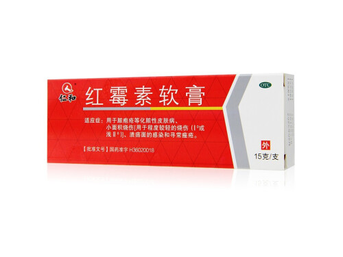 脂溢性皮炎用什么药 牛皮血癣症如何治