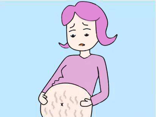 妊娠斑和黄褐斑区别