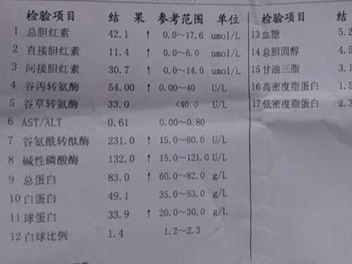谷胺酰转肽酶???