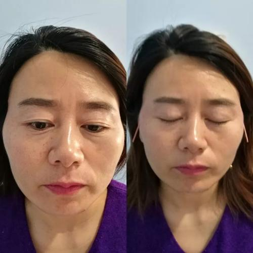 科琳卡青春定格液，打造“0”毛孔细腻肌
