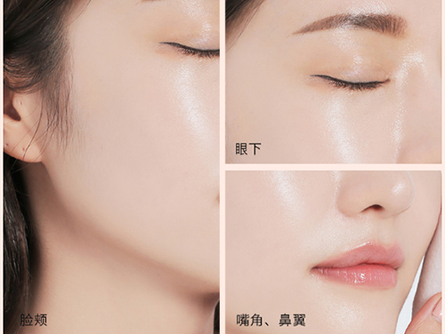 ARR气垫