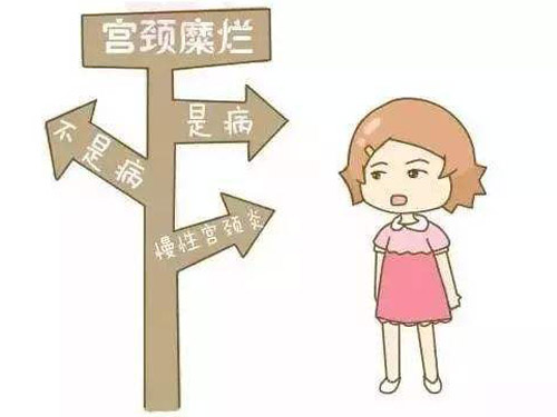 宫颈糜烂的症状