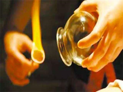 拔罐能去湿气吗