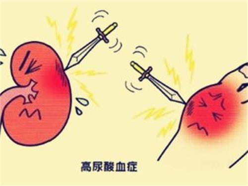 引起尿酸高的原因