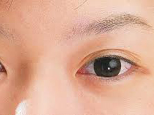 眼皮一直跳怎么办