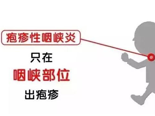 疱疹性咽峡炎能自愈吗