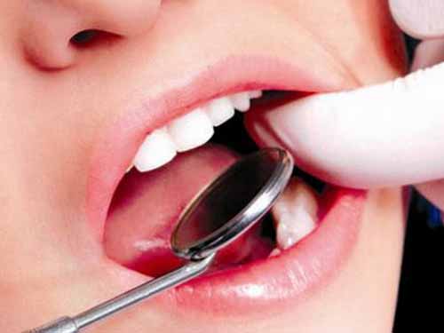 多久洗牙一??比较???