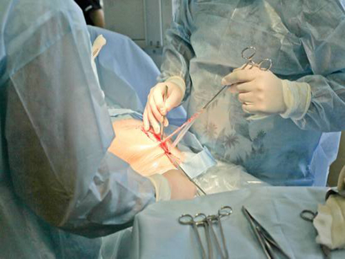 剖腹产后恶露多久排完