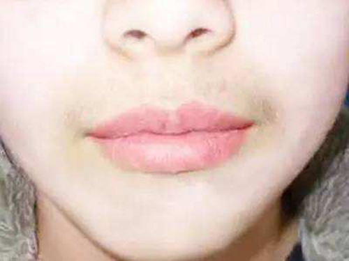 女孩汗毛重吃什??调理