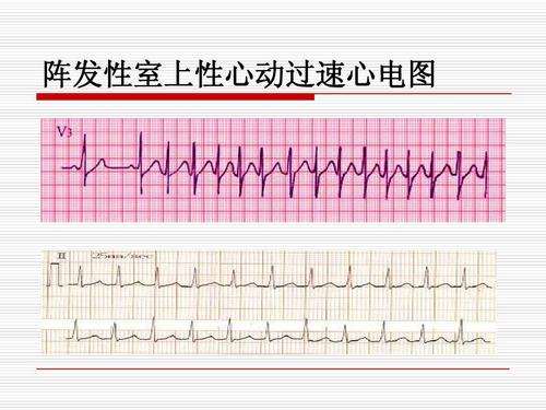 心律过快是什么原???