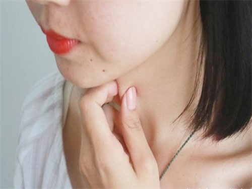 嗓子有痰吃什么好