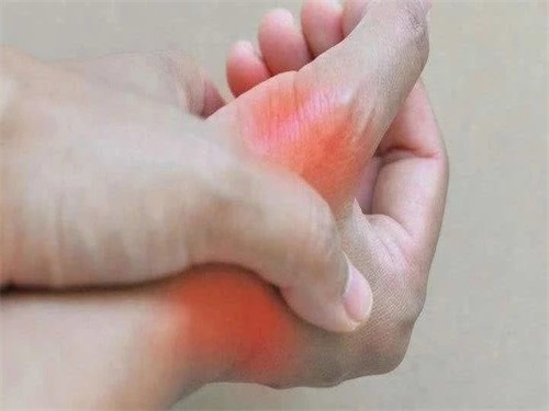 尿酸偏高能治好吗