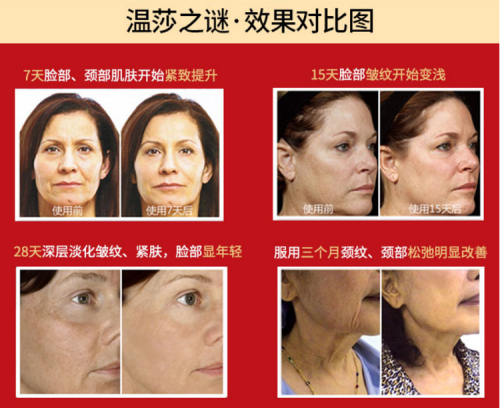 温莎之谜胶原蛋白肽，美容抗衰首选它！