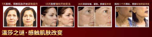 温莎之谜金纯抗衰小分子胶原蛋白肽，留住青春留住美！