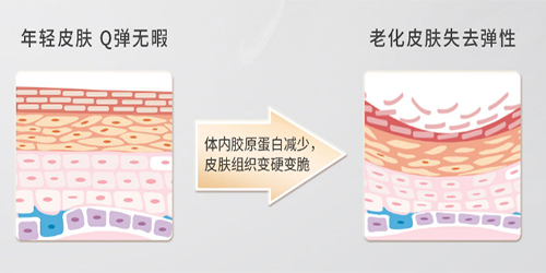 维萃美花胶饮：美味膳食补充胶原蛋白，青春驻留不是梦