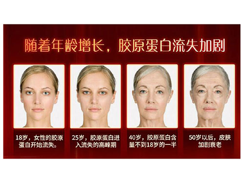 温莎之谜低分子鱼胶原蛋白肽，年轻肌肤的法宝