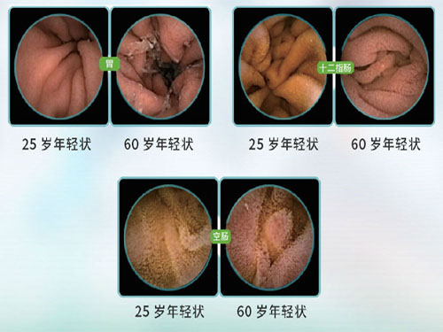 腸胃黏膜敏感易受刺激，維萃美胃腸膠囊助你恢復健康腸胃
